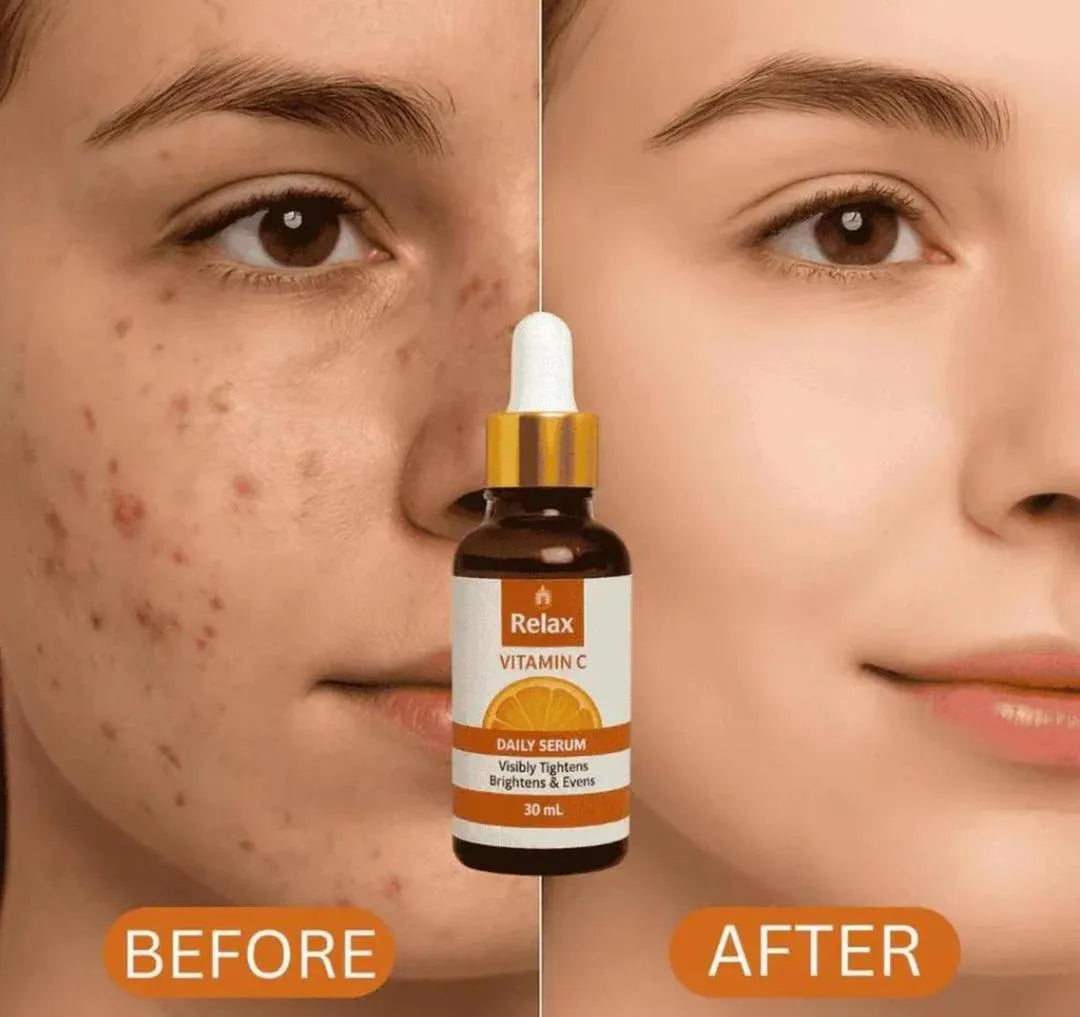Vitamin C Serum 30 ml | Glow Boost